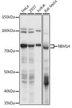 RBM14 Antibody in Western Blot (WB)