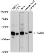 PARVB Polyclonal Antibody