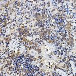 PER2 Antibody in Immunohistochemistry (Paraffin) (IHC (P))