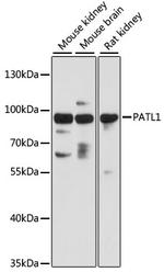 PATL1 Polyclonal Antibody