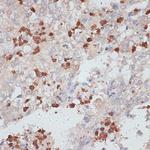 Cathepsin G Polyclonal Antibody