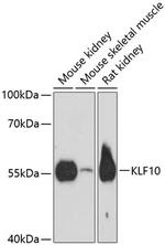 KLF10 Polyclonal Antibody