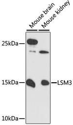 LSM3 Polyclonal Antibody