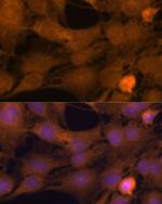 ZC3H7A Antibody in Immunocytochemistry (ICC/IF)