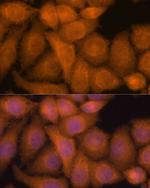 ZC3H7A Antibody in Immunocytochemistry (ICC/IF)