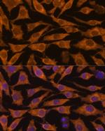 ZC3H7A Polyclonal Antibody