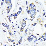 MRPL45 Antibody in Immunohistochemistry (Paraffin) (IHC (P))