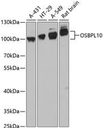 OSBPL10 Polyclonal Antibody