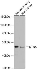 NTN5 Polyclonal Antibody