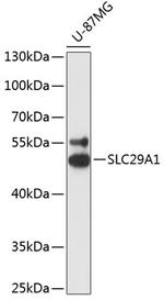 ENT1 Polyclonal Antibody