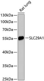 ENT1 Polyclonal Antibody