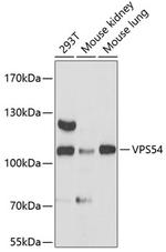 VPS54 Polyclonal Antibody