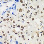 LARP2 Polyclonal Antibody