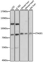 CTAGE1 Polyclonal Antibody