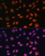 AROS Polyclonal Antibody