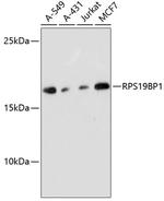 AROS Antibody in Western Blot (WB)