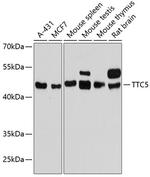 TTC5 Polyclonal Antibody