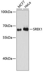 SFRS12 Polyclonal Antibody