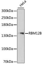RBM12B Antibody in Western Blot (WB)
