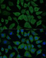 IDH1 Polyclonal Antibody