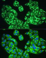 YTHDF1 Antibody in Immunocytochemistry (ICC/IF)