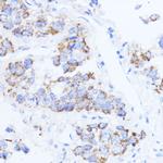 ACAT1 Polyclonal Antibody