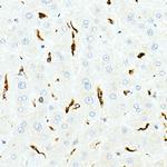 CD68 Antibody in Immunohistochemistry (Paraffin) (IHC (P))