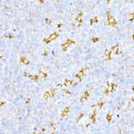 Cathepsin D Polyclonal Antibody