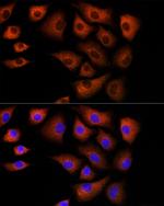 DBI Polyclonal Antibody