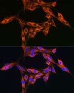 DBI Antibody in Immunocytochemistry (ICC/IF)