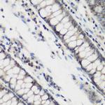 DHODH Antibody in Immunohistochemistry (Paraffin) (IHC (P))