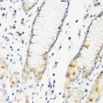 DHODH Antibody in Immunohistochemistry (Paraffin) (IHC (P))