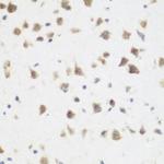 DHODH Antibody in Immunohistochemistry (Paraffin) (IHC (P))