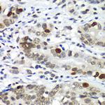 DR1 Antibody in Immunohistochemistry (Paraffin) (IHC (P))