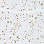 ETV1 Antibody in Immunohistochemistry (Paraffin) (IHC (P))