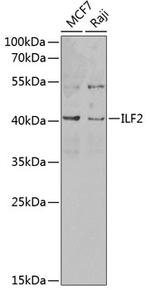 ILF2 Polyclonal Antibody