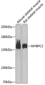 MYBPC2 Polyclonal Antibody