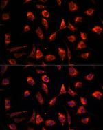 TPT1 Antibody in Immunocytochemistry (ICC/IF)