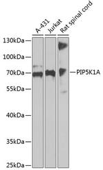 PIP5K1A Antibody in Western Blot (WB)