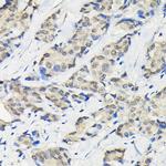 SSNA1 Polyclonal Antibody