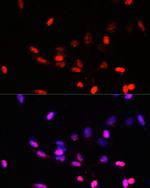 JAB1 Polyclonal Antibody