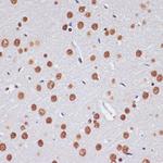 MNAR Antibody in Immunohistochemistry (Paraffin) (IHC (P))