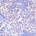 MNAR Antibody in Immunohistochemistry (Paraffin) (IHC (P))