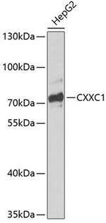 CGBP Antibody in Western Blot (WB)
