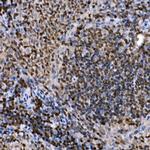 PHF11 Antibody in Immunohistochemistry (Paraffin) (IHC (P))