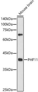 PHF11 Antibody in Western Blot (WB)