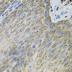 Adenylate Kinase 1 Polyclonal Antibody