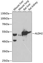 ALDH2 Polyclonal Antibody