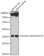 Annexin A4 Polyclonal Antibody