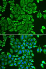 APEH Polyclonal Antibody